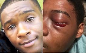 Toronto police officer found guilty of assault, brother not guilty, in  Dafonte Miller beating case | CBC News